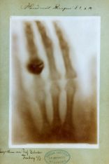 Historische Röntgen-Aufnahme: Anna Röntgens linke Hand